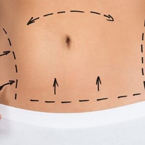 lipo--1200x720