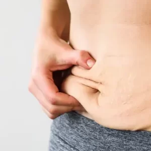 woman-belly-after-dieting-2022-0